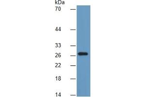 Western Blotting (WB) image for Prolactin (PRL) ELISA Kit (ABIN6730950)