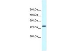 Image no. 1 for anti-Cold Shock Domain Containing C2, RNA Binding (CSDC2) (AA 21-70) antibody (ABIN6747761)