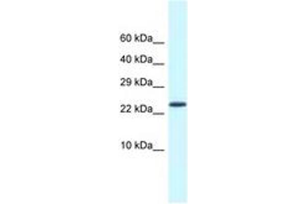 CSDC2 抗体  (AA 21-70)