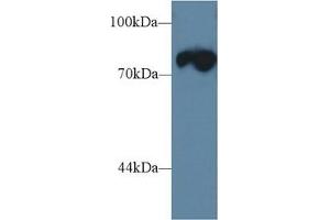 Detection of TRDN in Mouse Skeletal muscle lysate using Polyclonal Antibody to Triadin (TRDN)