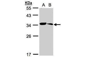 WB Image Sample(30 ug whole cell lysate) A:293T B:Raji , 12% SDS PAGE antibody diluted at 1:1000 (MMACHC antibody  (Center))