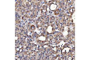 IHC analysis of SARS2 using anti-SARS2 antibody (ABIN7601804). (SARS2 antibody  (AA 46-518))