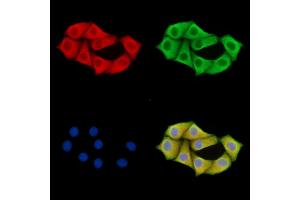 ABIN7095870 and ABIN7099932 staining Hela cells by IF/ICC.