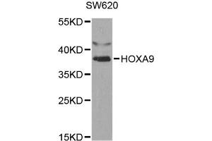 Western blot analysis of extracts of SW620 cells, using HOXA9 antibody (ABIN5970979) at 1/1000 dilution. (HOXA9 antibody)