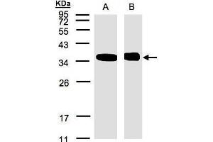 WB Image Sample(30 μg of whole cell lysate) A:293T B:Raji, 12% SDS PAGE antibody diluted at 1:500 (NMI antibody)