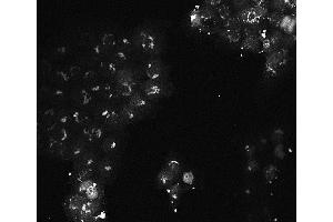 Immunofluorescence of Mouse monoclonal anti-AKT3 antibody Cell Type: A431 cells Fixation: 4% paraformaldehyde 10 min Permeablization: 0.