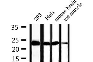 Western blot analysis of extracts from 293,Hela,mouse brain and rat muscle, using TPT1 Antibody. (TPT1 antibody  (Internal Region))