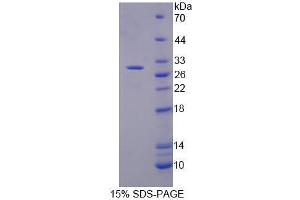 SDS-PAGE analysis of Human Mucin 17 Protein.