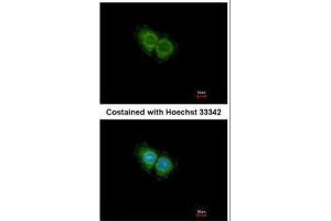 ICC/IF Image Immunofluorescence analysis of methanol-fixed Hep G2, using CXCR1, antibody at 1:500 dilution. (CXCR1 antibody  (C-Term))