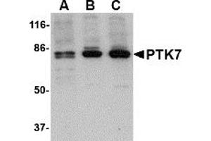 Western Blotting (WB) image for anti-PTK7 Protein tyrosine Kinase 7 (PTK7) (N-Term) antibody (ABIN1031528)