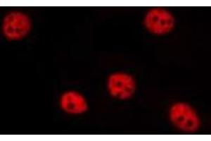 ABIN6275638 staining Hela by IF/ICC. (GTF3A antibody  (N-Term))