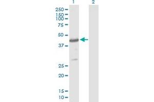 Western Blot analysis of CYTH4 expression in transfected 293T cell line by CYTH4 MaxPab polyclonal antibody. (Cytohesin 4 antibody  (AA 1-394))