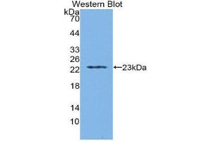 Western Blotting (WB) image for anti-Tryptophanyl-tRNA Synthetase (WARS) (AA 29-195) antibody (ABIN1860958)