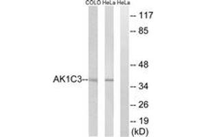 Western blot analysis of extracts from HeLa/COLO cells, using AKR1C3 Antibody.
