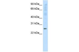 WB Suggested Anti-SNAP25 Antibody Titration:  0. (SNAP25 antibody  (C-Term))