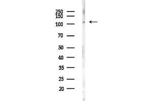 Western blot analysis of lysates from PC12 cells, using SMCR8 Antibody at 1/1000 dilution.