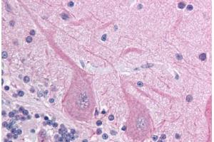 Human Brain, Cerebellum (formalin-fixed, paraffin-embedded) stained with ACCN4 antibody ABIN214725 at 5 ug/ml followed by biotinylated goat anti-rabbit IgG secondary antibody ABIN481713, alkaline phosphatase-streptavidin and chromogen. (ACCN4 antibody  (AA 121-170))