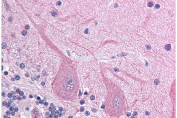 ACCN4 antibody  (AA 121-170)