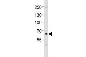 Western blot analysis of lysate from SK-N-MC cell line using PCSK9 antibody at 1:1000. (PCSK9 antibody  (C-Term))