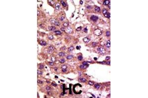 Immunohistochemistry (IHC) image for anti-Autocrine Motility Factor Receptor (AMFR) antibody (ABIN2995186) (AMFR antibody)