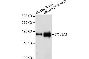 Western blot analysis of extracts of various cell lines, using COL3A1 antibody (ABIN5971985) at 1/1000 dilution. (COL3A1 antibody)