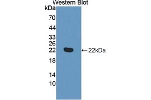 HVEM antibody  (AA 41-209)