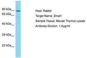 ZMAT1 antibody  (AA 301-350)