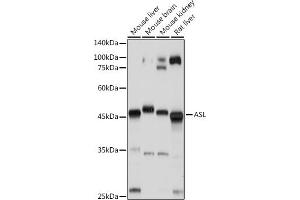Western blot analysis of extracts of various cell lines, using ASL antibody (ABIN6127448, ABIN6137201, ABIN6137202 and ABIN6221972) at 1:1000 dilution. (ASL antibody  (AA 1-300))