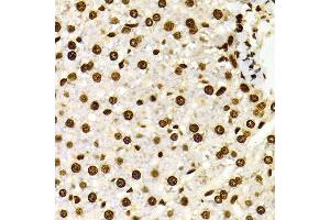 Immunohistochemistry of paraffin-embedded Rat liver using H3K27me2 antibody at dilution of 1:100 (x400 lens). (Histone 3 antibody  (H3K27me))