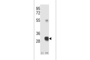 Western blot analysis of RCE1 (arrow) using rabbit polyclonal RCE1 Antibody (W57) (ABIN389050 and ABIN2839259). (RCE1/FACE2 antibody  (N-Term))