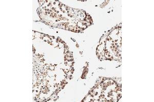Immunohistochemistry (Paraffin-embedded Sections) (IHC (p)) image for anti-Interferon Induced Transmembrane Protein 5 (IFITM5) (AA 55-83) antibody (ABIN655010)
