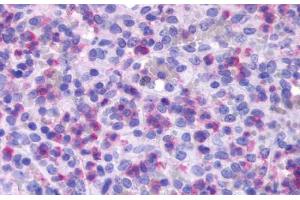 Anti-FPR1 antibody  ABIN1048603 IHC staining of human spleen, red pulp. (FPR1 antibody  (Extracellular Domain))