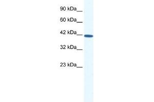WB Suggested Anti-SOX11 Antibody Titration: 0. (SOX11 antibody  (N-Term))