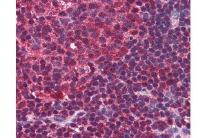 Anti-BLIMP-1 antibody IHC of human colon, lymphoid follicle. (PRDM1 antibody  (C-Term))
