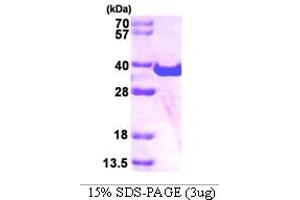 SDS-PAGE (SDS) image for Spastic Paraplegia 21 (SPG21) (AA 1-308) protein (His tag) (ABIN666752) (SPG21 Protein (AA 1-308) (His tag))