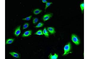 Immunofluorescent analysis of A549 cells using ABIN7165209 at dilution of 1:100 and Alexa Fluor 488-congugated AffiniPure Goat Anti-Rabbit IgG(H+L) (CNIH2 antibody  (AA 94-138))