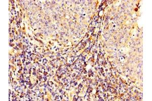 IHC image of ABIN7146540 diluted at 1:300 and staining in paraffin-embedded human tonsil tissue performed on a Leica BondTM system. (Calpain 2 antibody  (Catalytic Subunit))