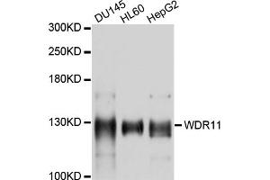 Western blot analysis of extracts of various cell lines, using WDR11 antibody (ABIN4905619) at 1:1000 dilution. (WDR11 antibody)