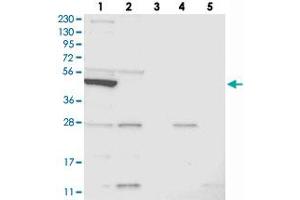 Western blot analysis of Lane 1: RT-4, Lane 2: U-251 MG, Lane 3: Human Plasma, Lane 4: Liver, Lane 5: Tonsil with SLC10A3 polyclonal antibody .