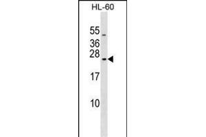 RAB20 Antibody (C-term) (ABIN1536837 and ABIN2849183) western blot analysis in HL-60 cell line lysates (35 μg/lane).