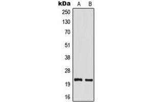 Western blot analysis of TM2D1 expression in MCF7 (A), mouse kidney (B) whole cell lysates. (TM2D1 antibody  (Center))