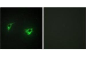 Immunofluorescence (IF) image for anti-Mitogen-Activated Protein Kinase Kinase Kinase Kinase 4 (MAP4K4) (AA 406-455) antibody (ABIN2889367) (MAP4K4 antibody  (AA 406-455))