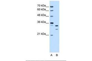 Image no. 2 for anti-Acidic (Leucine-Rich) Nuclear phosphoprotein 32 Family, Member E (ANP32E) (AA 151-200) antibody (ABIN6738242) (ANP32E antibody  (AA 151-200))
