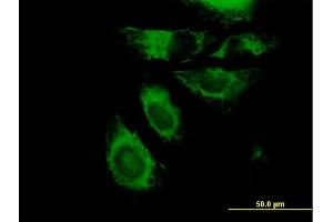 Immunofluorescence of purified MaxPab antibody to KRT7 on HeLa cell. (Cytokeratin 7 antibody  (AA 1-469))