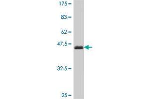 Western Blot detection against Immunogen (37. (Laminin beta 3 antibody  (AA 1064-1171))