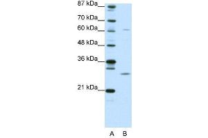 WB Suggested Anti-CRSP9  Antibody Titration: 0.