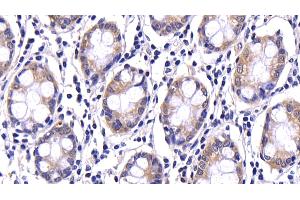 Detection of CASP9 in Human Colon Tissue using Polyclonal Antibody to Caspase 9 (CASP9) (Caspase 9 antibody  (AA 331-416))