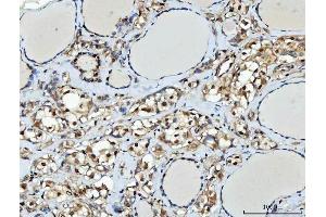 IHC analysis of TTLL12 using anti-TTLL12 antibody (ABIN7602497). (TTLL12 antibody  (AA 8-634))