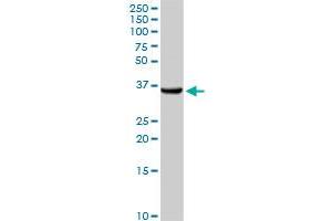 AKR1C1 antibody  (AA 1-323)