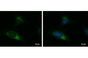 ICC/IF Image UGCGL2 antibody [N3C2], Internal detects UGCGL2 protein at endoplasmic reticulum by immunofluorescent analysis. (UGCGL2 antibody)